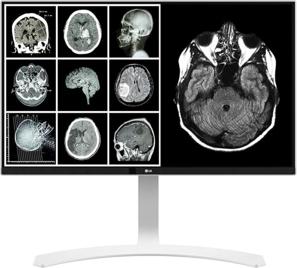 LG MONITOR CLINICO 8MP 27"